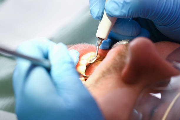 Best Emergency Treatment for Dental Infections or Abscesses in Mukwonago, WI